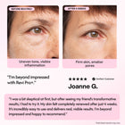 Revi Pro+ Before and after comparison of skin treatment with text and a customer review.