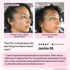 Revi Pro Before and after comparison of a woman's skin with text and a customer review on a pink background
