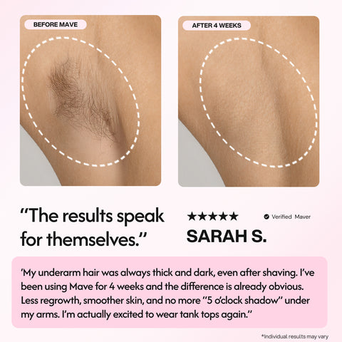 Mave IPL Hair Removal Handset
