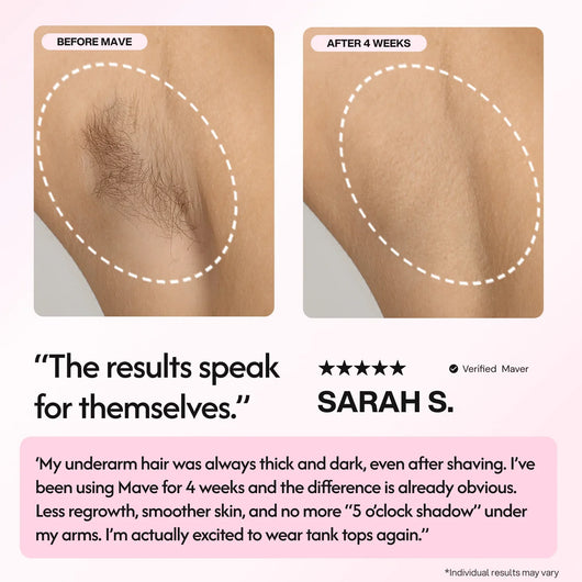 Mave IPL Hair Removal Handset - Smuuv Body