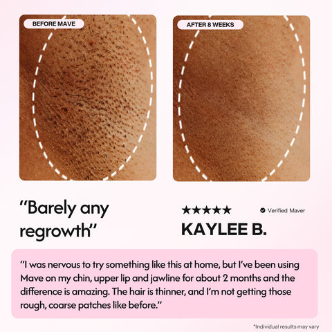 Mave IPL Hair Removal Handset