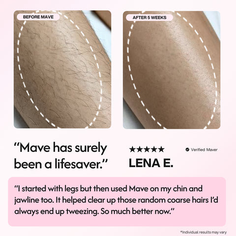 Mave IPL Hair Removal Handset
