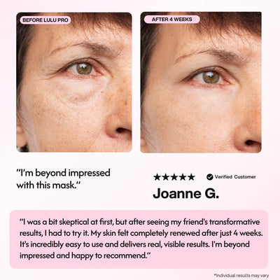 Lulu Pro LED Light Therapy Mask - Smuuv Body