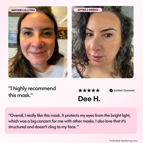 Lulu Pro LED Light Therapy Mask